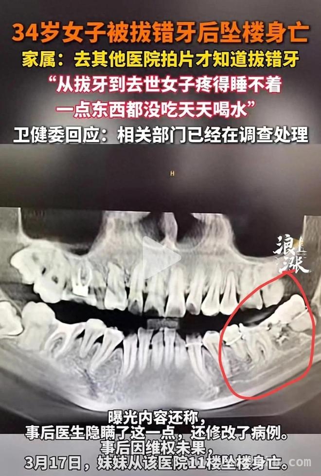 拔错牙致女子坠楼身亡，医院责任几何？，拔牙悲剧：34岁女子拔牙后坠楼，谁之过？