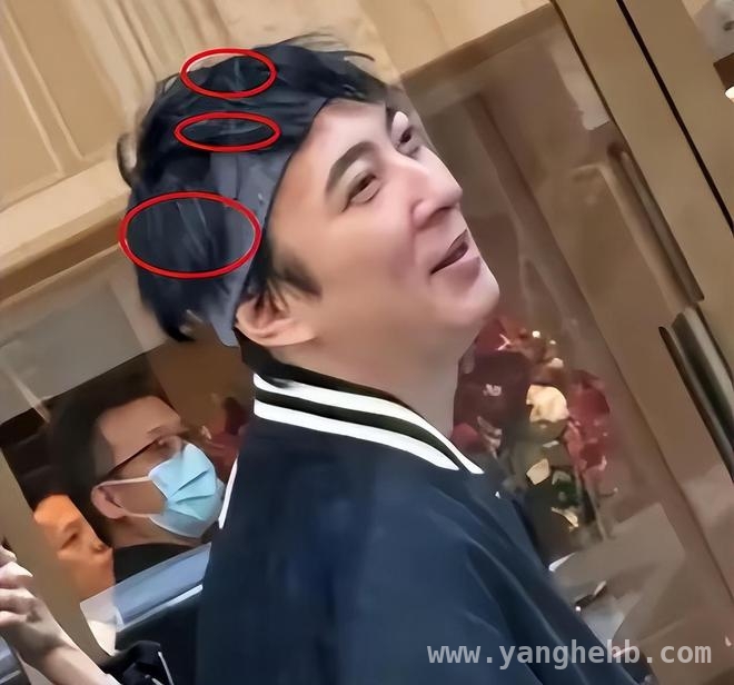 王思聪状态大变，是为万达危机愁白了头？，37岁王思聪白发凸显，万达债务危机影响几何？