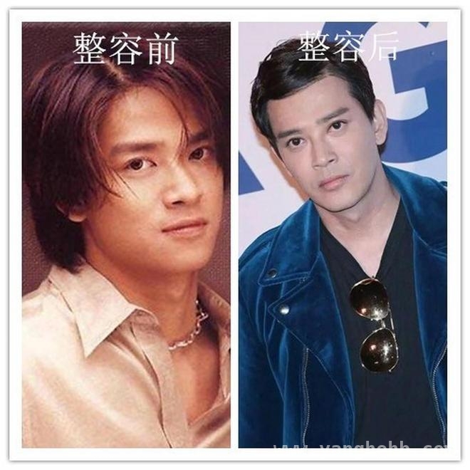 娱乐圈男神大变样，谁被医美“坑惨”了？